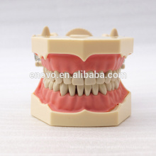 32 pcs Removable Teeth SF Type Dental Study Model for School Education 13009